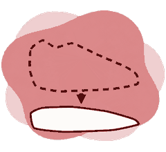Extra-Form